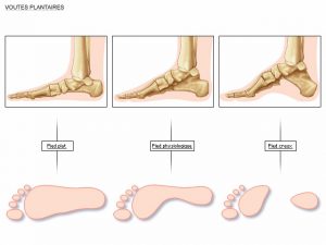 Autres pathologies du pied - Clinique du pied